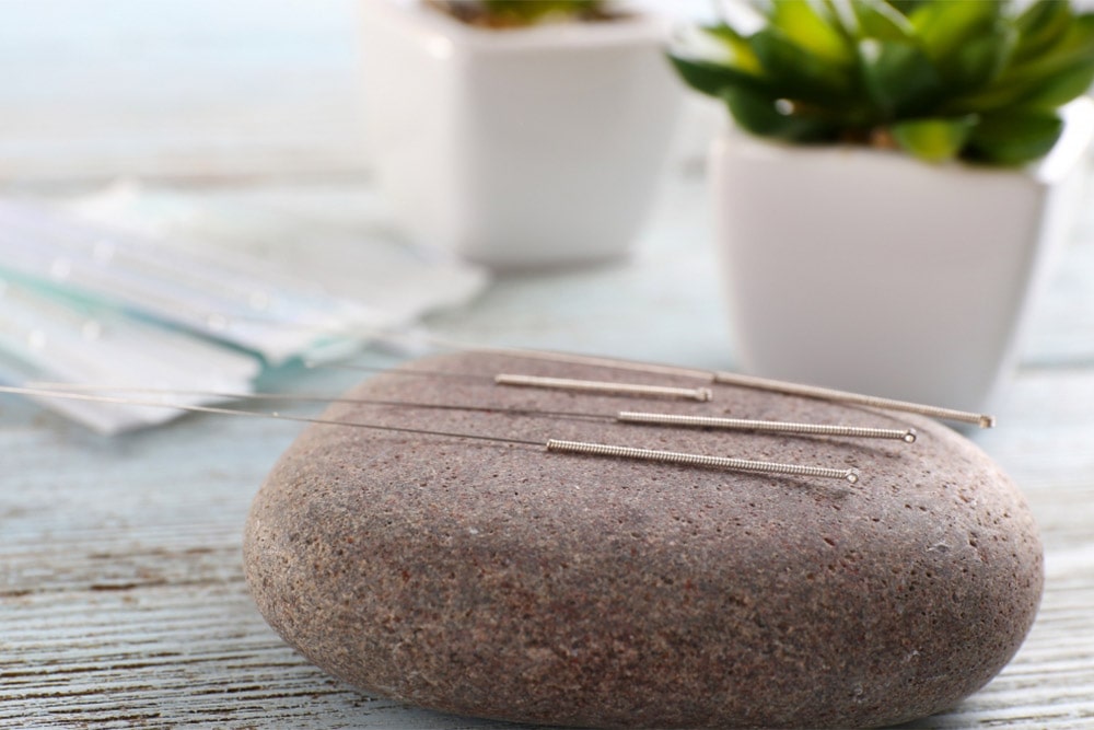 Agopuntura Ticino Lugano