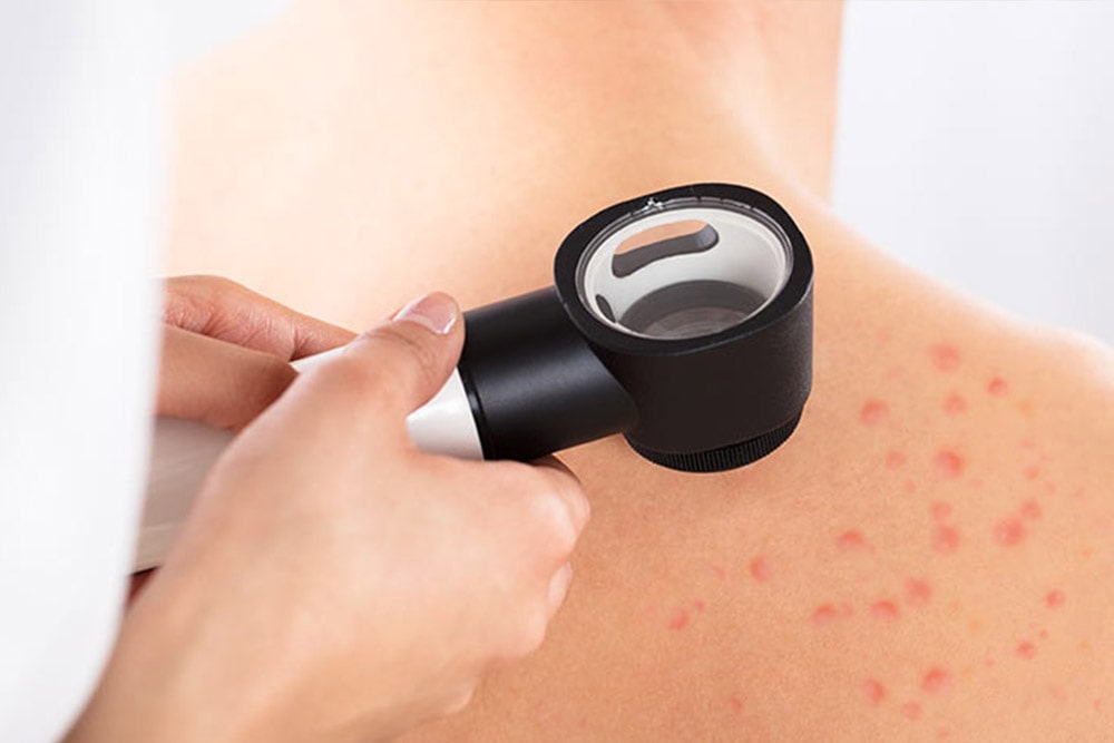 Dermatologia Medicina Tradizionale Cinese